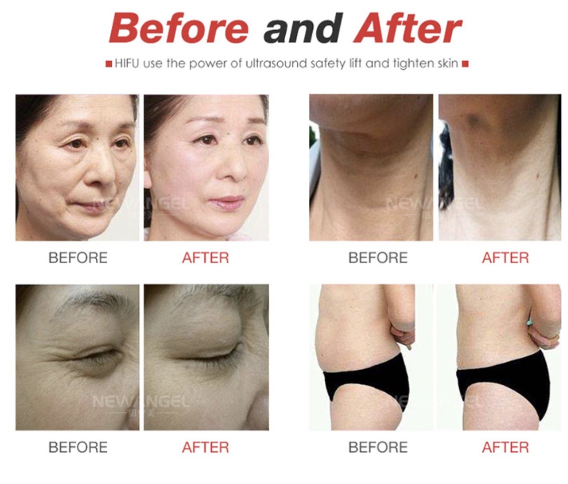 IMG_3560_BeforeAfter.jpg IMG_3560_BeforeAfter.jpg