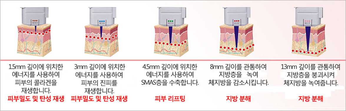 hifu-glowica.jpg hifu-glowica.jpg
